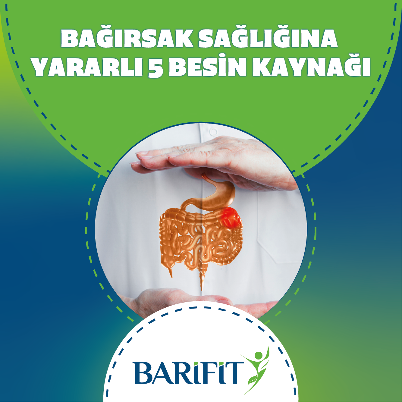 Bağırsak Sağlığına Yararlı 5 Besin Kaynağı